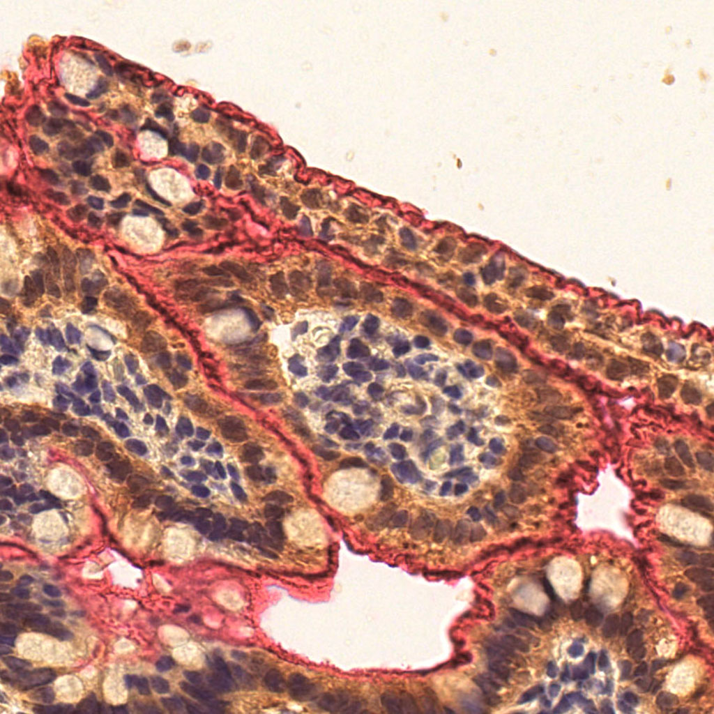sars-cov-2 gene expression in a human fetus